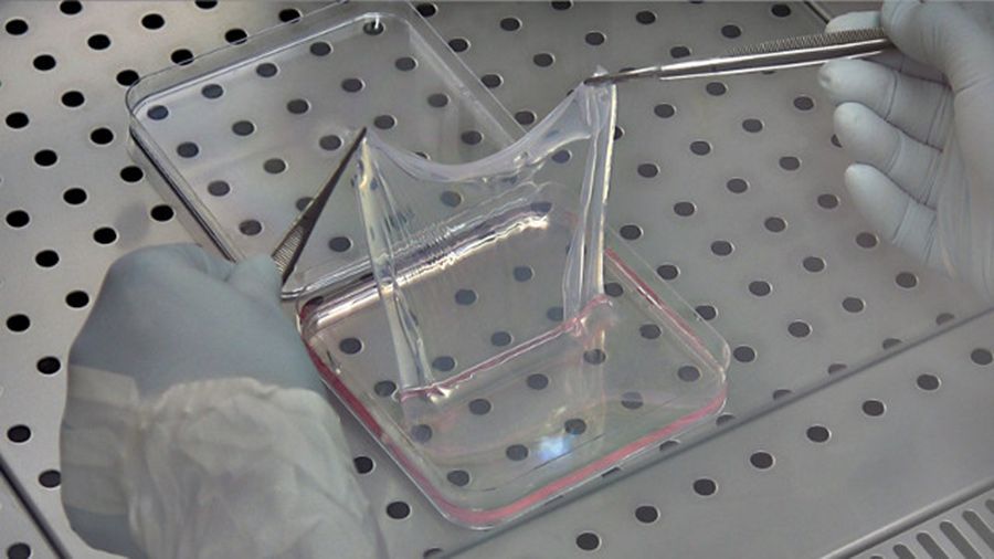 Θεραπεία με διαγονιδιακό δέρμα | Biology.gr